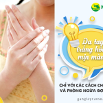 Da tay trắng hồng mịn màng với các cách chăm sóc và phòng ngừa đơn giản