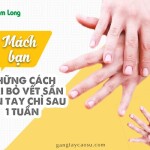 Mách bạn những cách loại bỏ vết chai sần trên tay sau 1 tuần