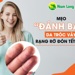 Mẹo “đánh bay” da bị khô tróc vảy trắng, rạng rỡ đón Tết xinh